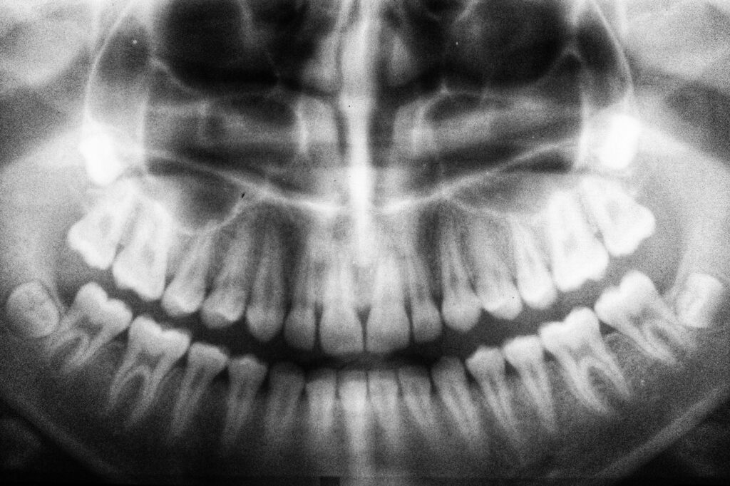 diagnóstico para un dolor de muelas insoportable