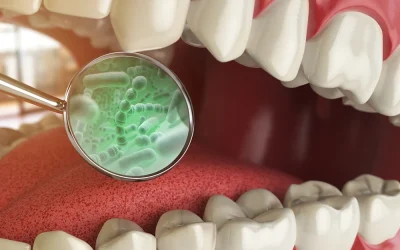 Encías inflamadas o sangrantes: cómo reforzar el cuidado gingival con MANA DENTAL