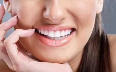 ¿Cuándo acudir al dentista para mejorar la estética de tu sonrisa en Castellón?